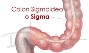 SIGMA COLON SIGMOIDEO SIGMA COLON SIGMOIDEO