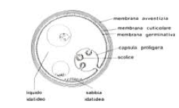 Visione schematica di cisti da Echinococco