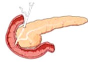 Pancreas Pancreas